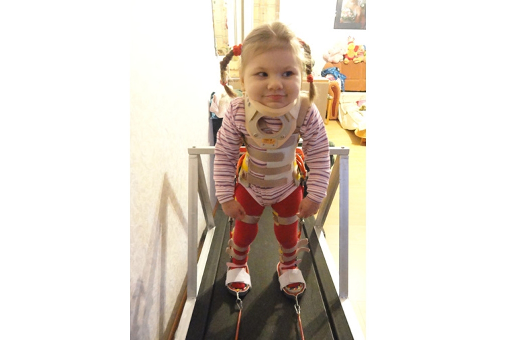 Anastasijai ir smags galvas smadzeņu traucējums. Četru gadu vecumā viņa vēl gandrīz nekustās. Rehabilitācijai ir nepieciešami 5843,00 eiro.