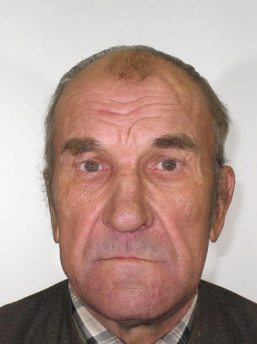 Alberts Logins.
Autors: no policijas arhīva