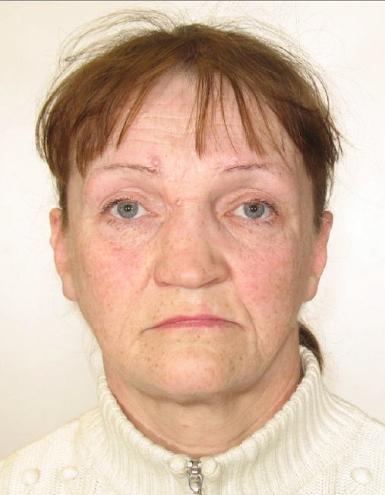 Cēsu policija lūdz iedzīvotāju palīdzību 1963.gadā dzimušās Annas Vinkas meklēšanā, kura 16.jūlijā, izgāja no savas dzīves vietas Cēsīs, L.Katrīnas ielā 26 un līdz šim brīdim nav informācijas par viņas atrašanās vietu.
Autors: no policijas arhīva