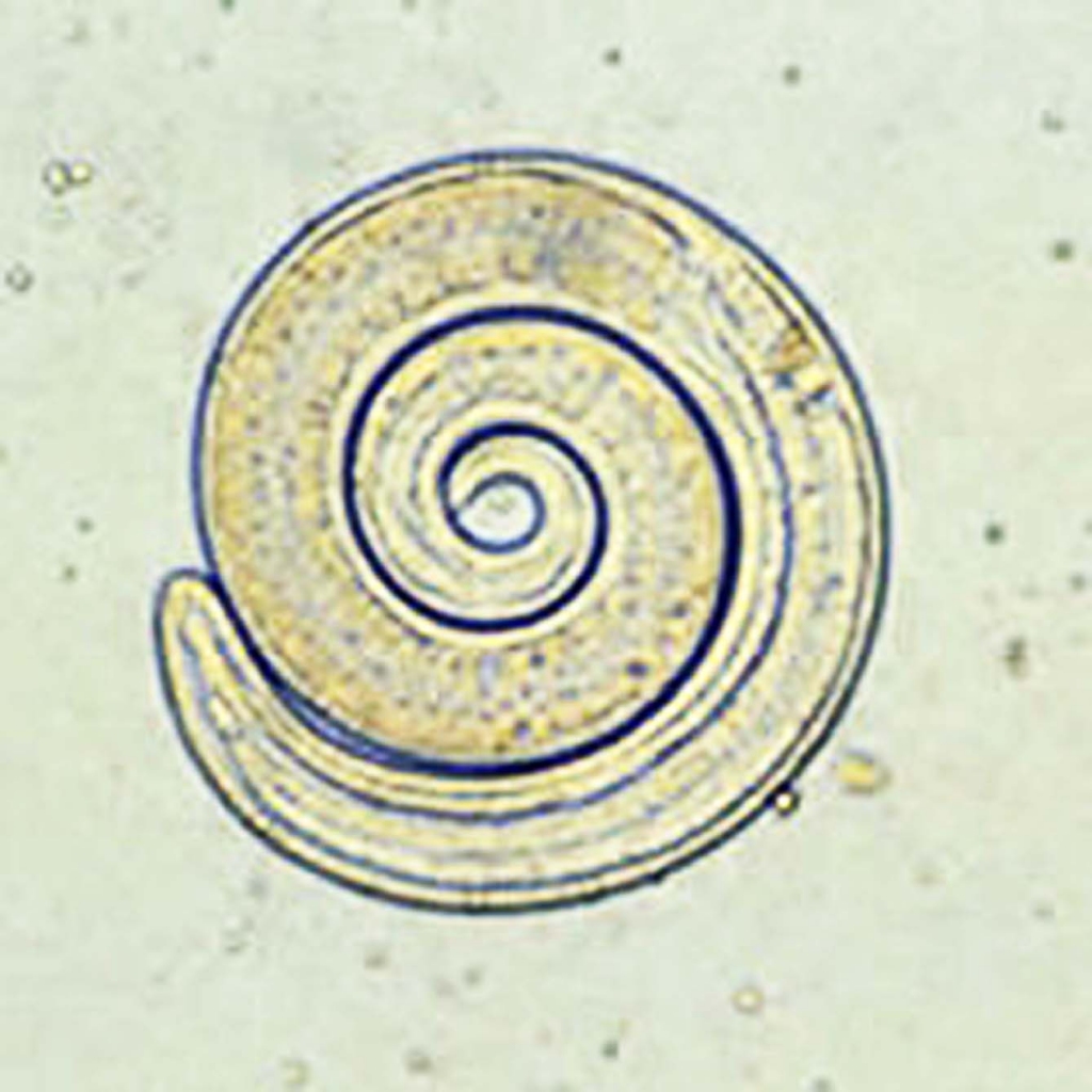 Kāpura spirālveida forma.