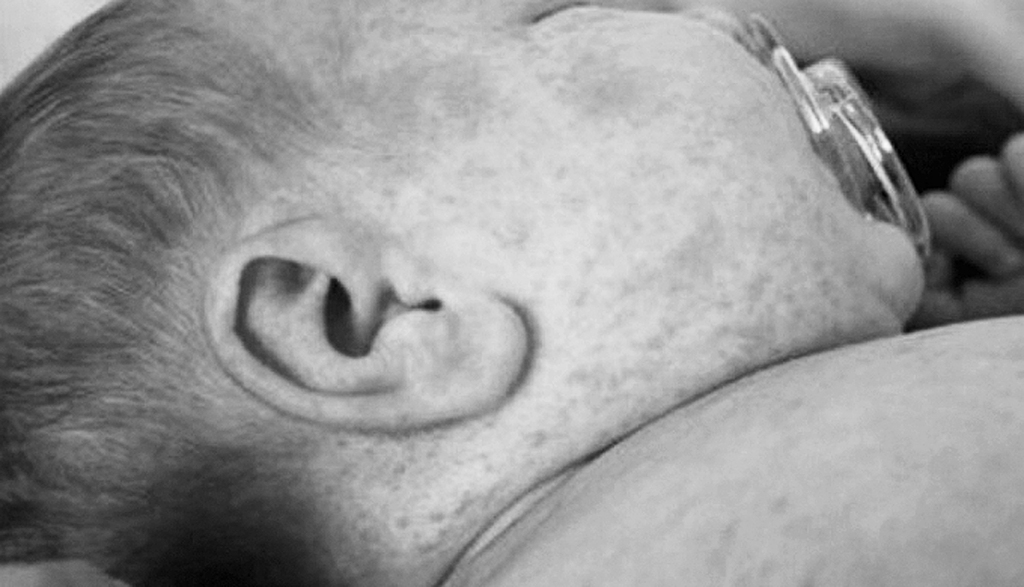 Vissmagākajā formā ar masalām slimo pieaugušie, kā arī bērni līdz viena gada vecumam. Tāpat slimība ir bīstama grūtniecēm, jo var izraisīt augļa bojāeju vai priekšlaicīgas dzemdības.
Autors: NO WWW.ZIEMELLATVIJA.LV