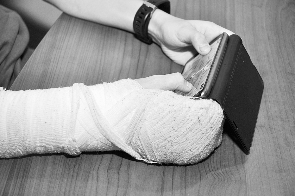 Ja šķiet, ka kauli lūst pārāk viegli, vispirms noteikti jākonsultējas ar ģimenes ārstu. Tas var nosūtīt pie ortopēda, endokrinologa, ja ir aizdomas par vielmaiņas traucējumiem, vai ģenētiķa, ja iemesls varētu būt iedzimta kaulu problēma.
Autors: DAINIS ĢELZIS