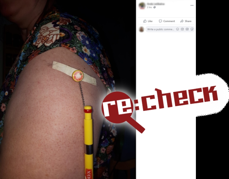 Ieraksta autore vēlāk attēlam pievienoja skaidrojumu, ka zem plākstera rokai pielīmēts vēl viens magnēts.
Autors: no “rebaltica.lv”